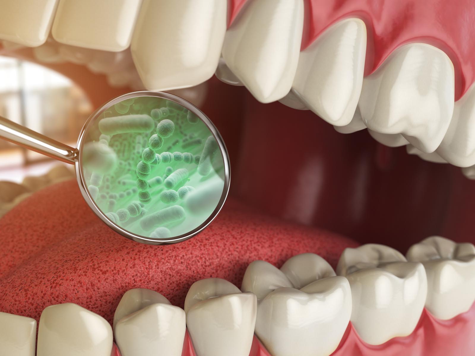 Halitosis (Bad Breath)  Treatment